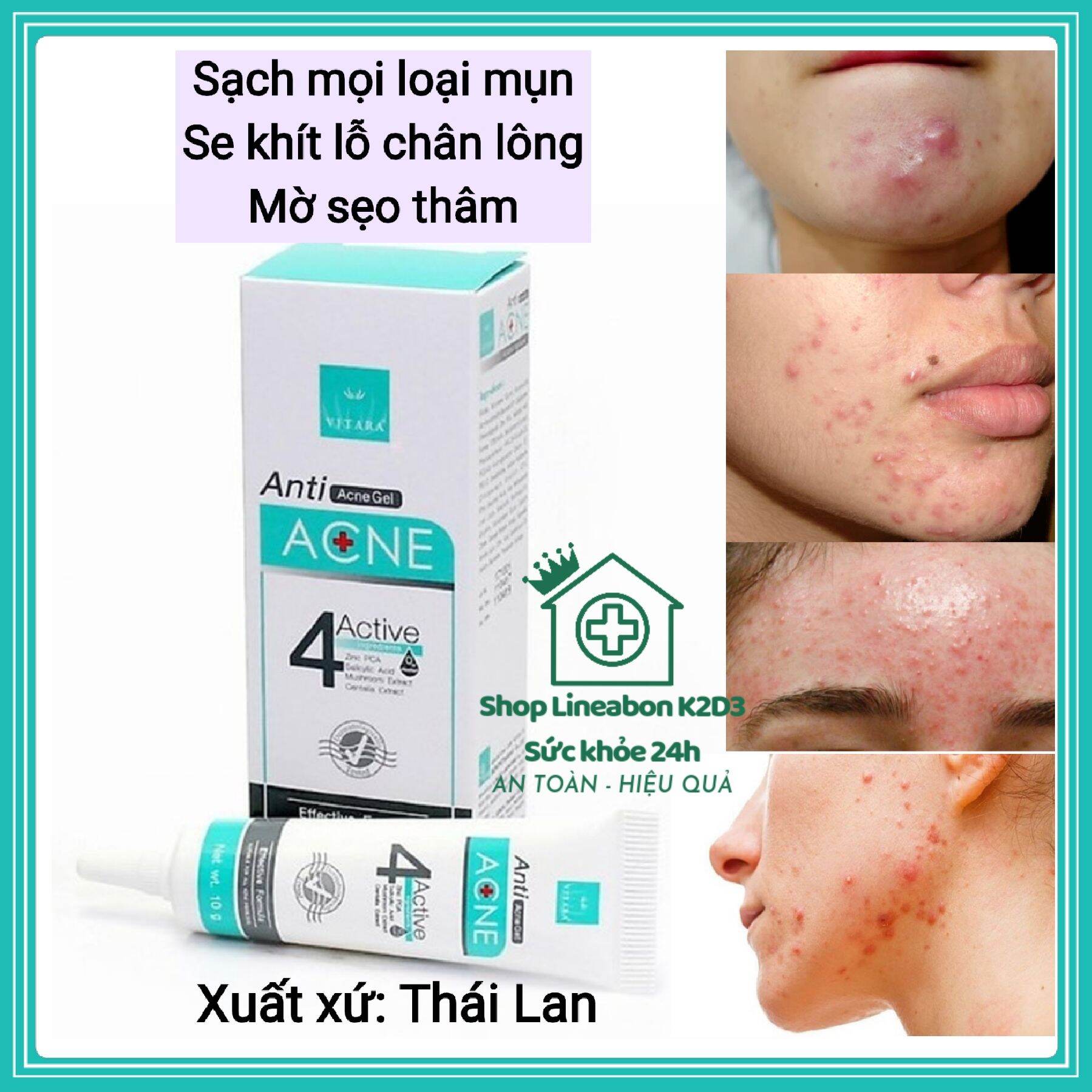 Gel bôi mụn 4 tác động vitara anti acne gel 10g thái lan hết mụn, se khít lỗ chân lông