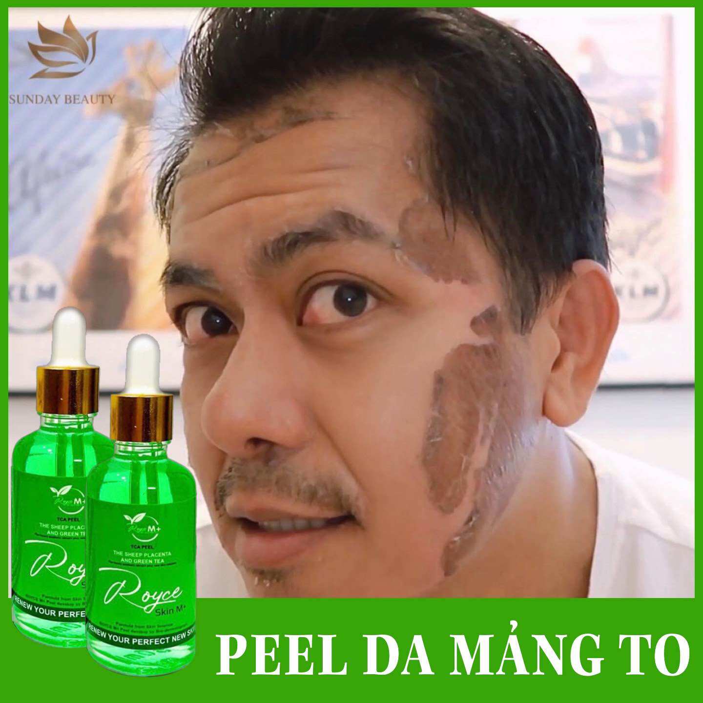 Peel da bong mảng to royce skin m+ peel da - peel da - peel da