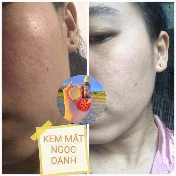 kem face Ngọc Oanh