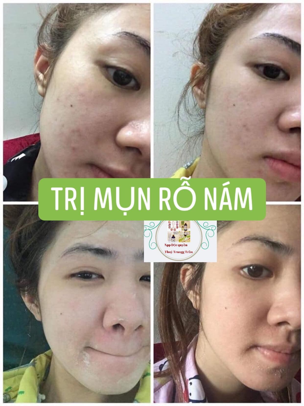 Tái Tạo Da (50ml).