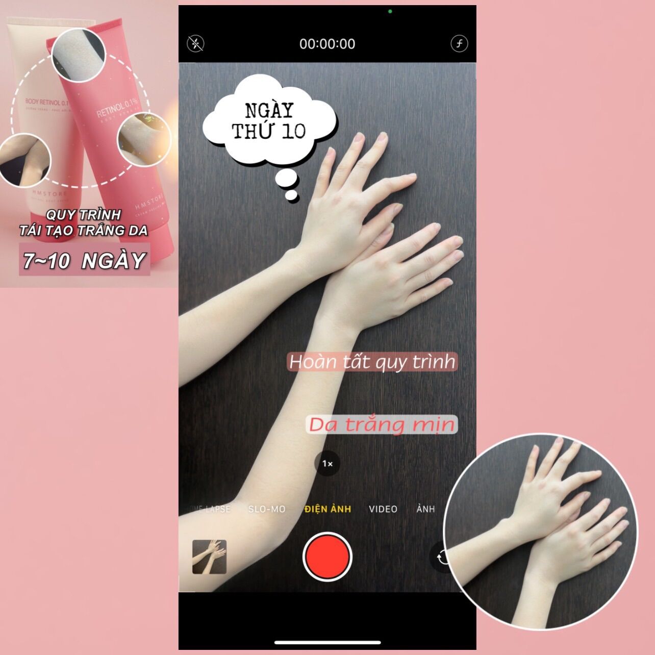 Combo Peel Da Body RETINOL ( Thay Da Sinh Học Hm store )