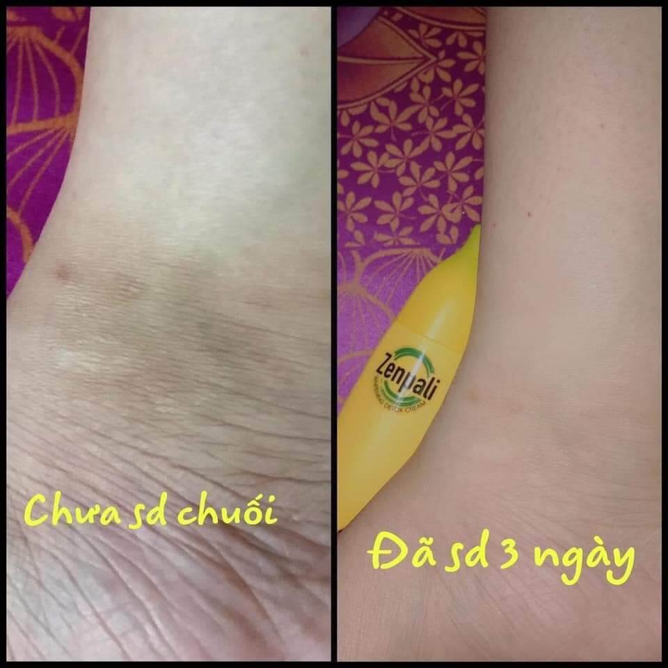 🍌🍌🍌Chuối Zenpali - Cấy trắng Detox Thải Chì Thải Độc🍌🍌🍌