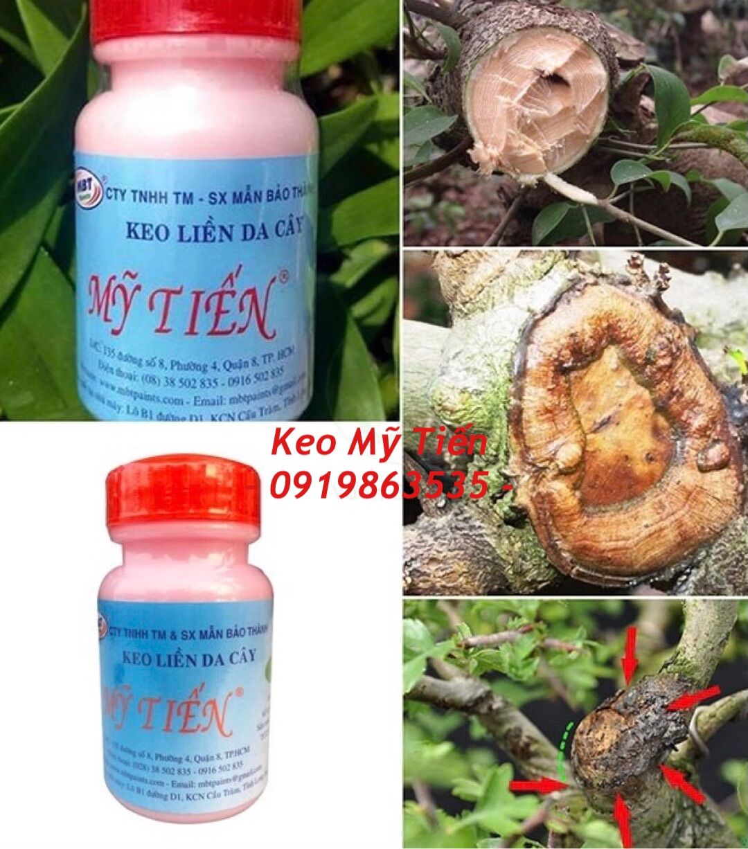 KEO LIỀN SẸO - KEO MỸ TIẾN