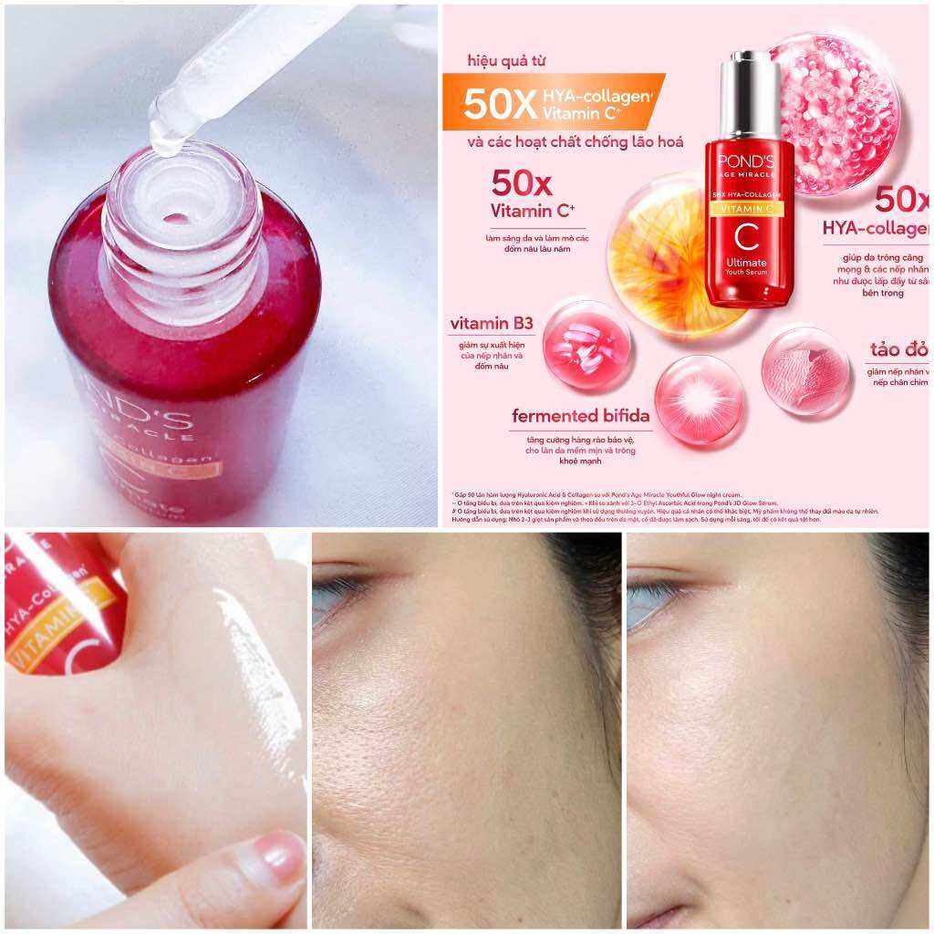 01 Hộp 6 gói Serum Pond’s Vitamin C tinh chất dưỡng sáng mờ đốm nâu POND'S Age Miracle Ultimate Youth Vitamin C HA Collagen - gói serum pond’s đỏ 7g