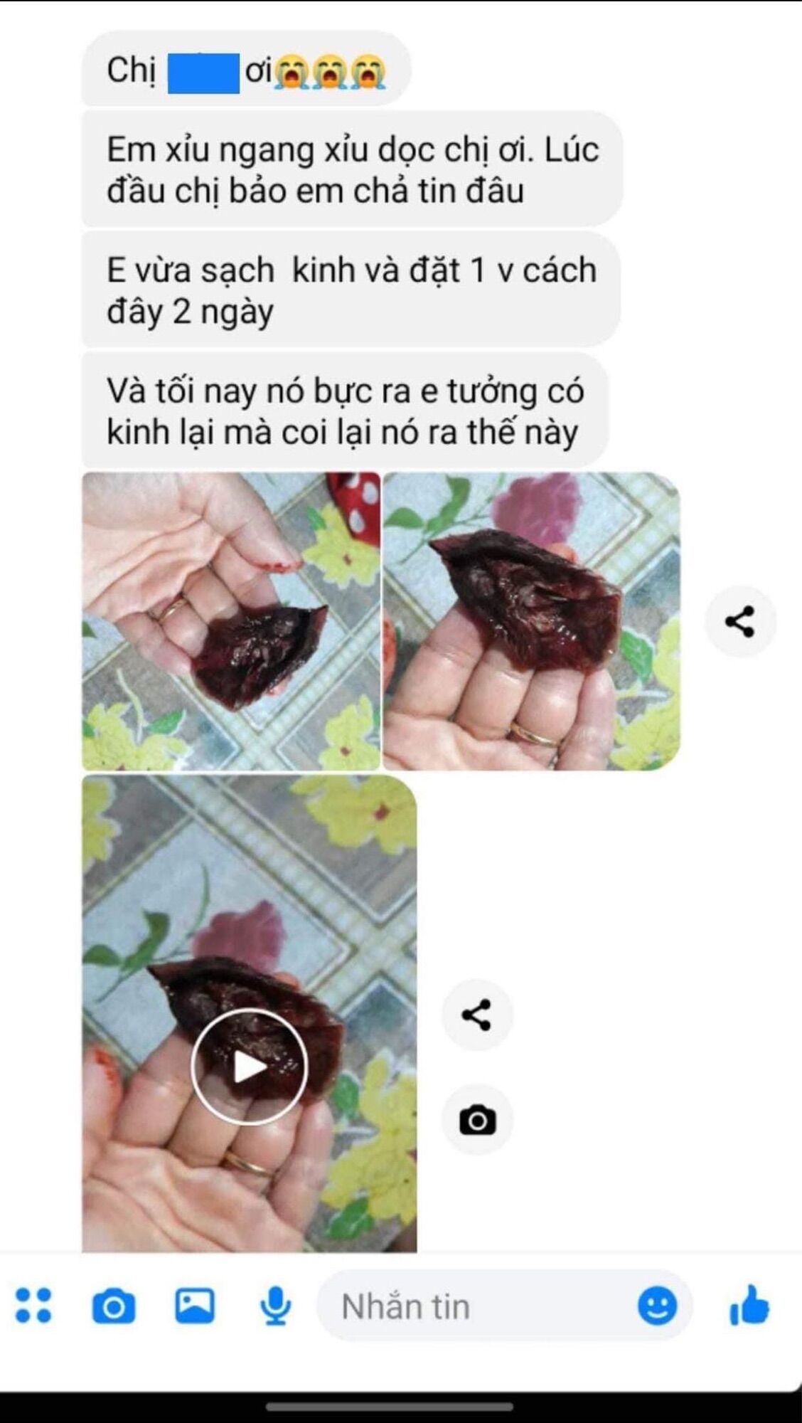 Viên Đ.ặt T.iêu V.iêm Pk ( tách lẻ 5 viên dùng thử)