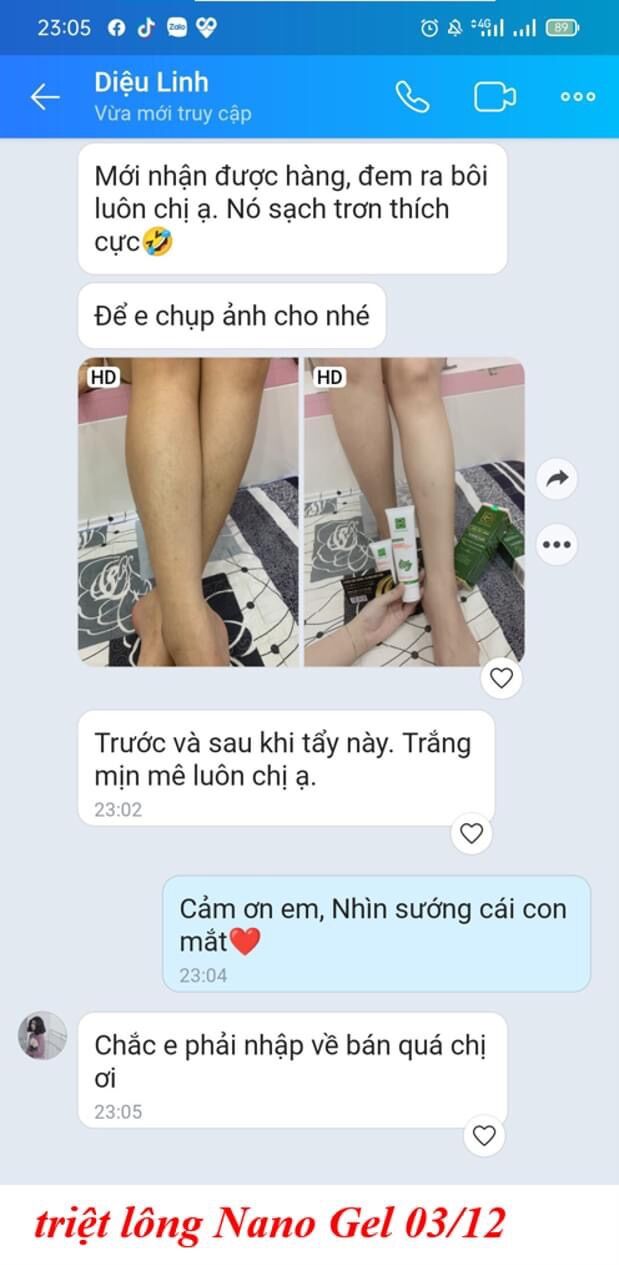KEM TRIỆT LÔNG NANO GEL