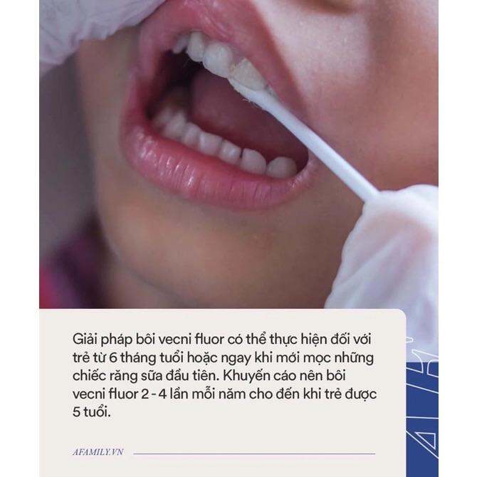 VECNI FLOUR Kem bôi răng chống sâu răng, kem bôi răng chống sún răng cho bé