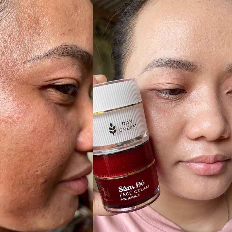 Combo face nám và yến mạch