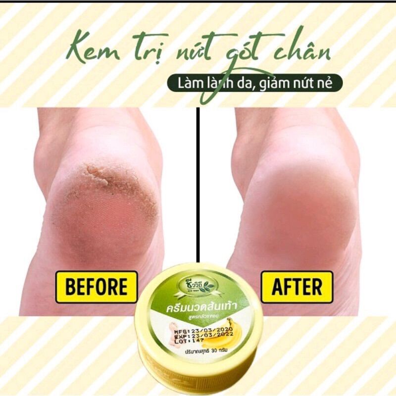 Kem Dưỡng Nứt Gót Chân Chuối Thái Lan 30g