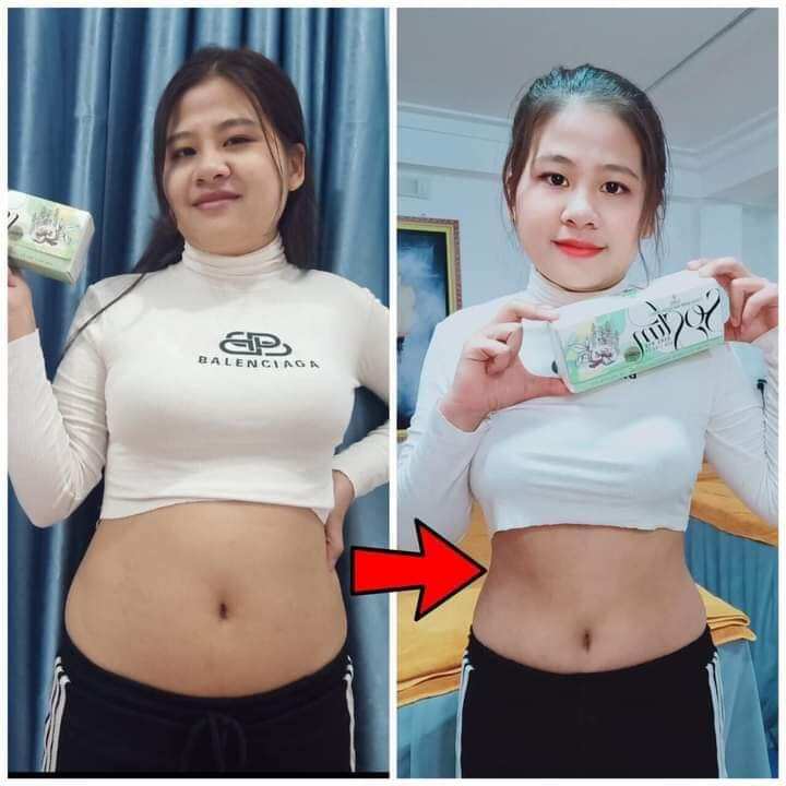 KẸO GIẢM CÂN SOSLIM