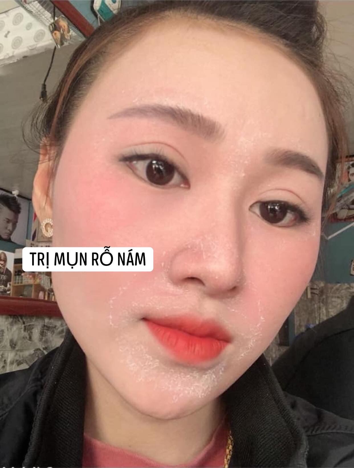 Tái Tạo Da (50ml).