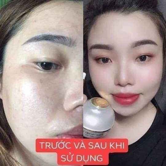 [TẶNG KÈM SERUM VÀNG 24K+ MẶT NẠ] Kem face vip 7 in 1 Huỳnh Đỗ