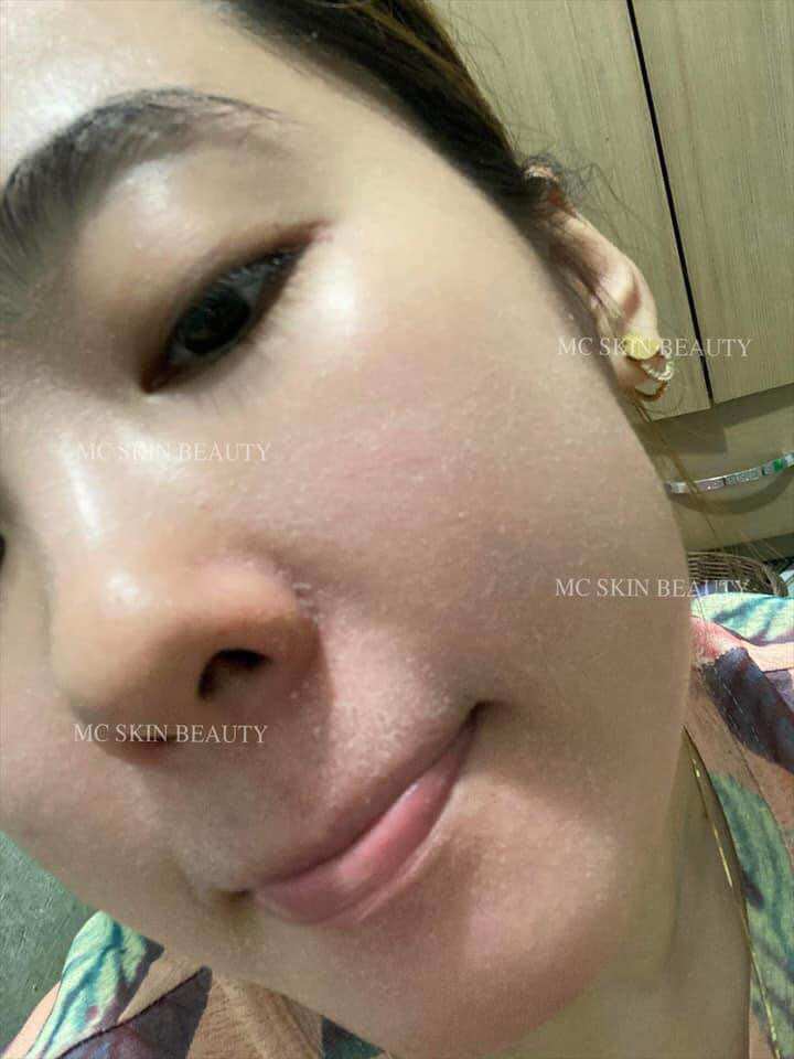 COMBO TÁI TẠO HỒNG SÂM MCSKIN