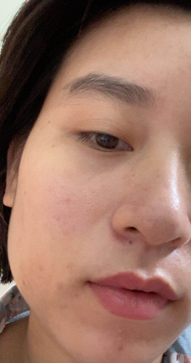 SERUM BHA MỤN HESHI