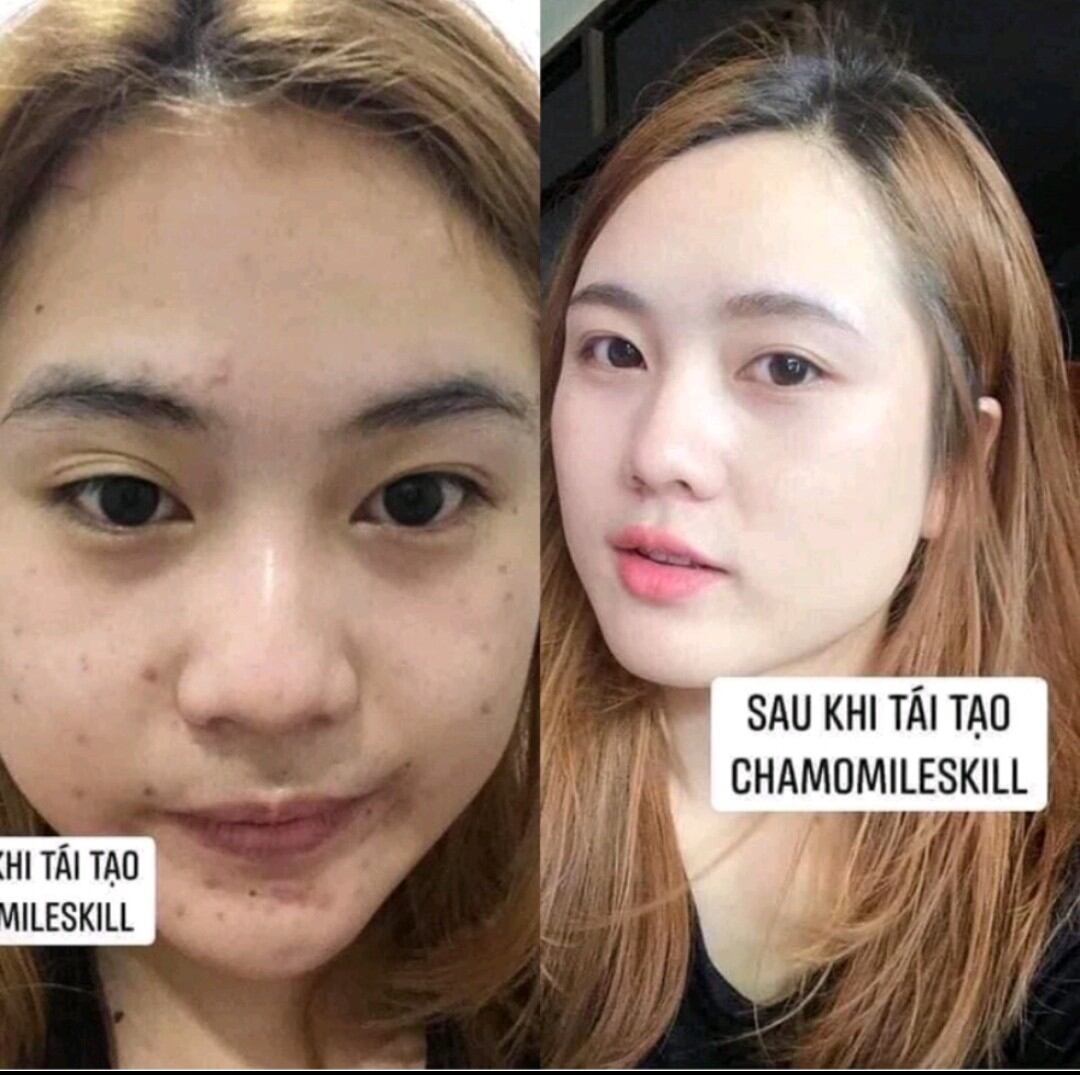 Kem tái tạo vàng Chamomile skill