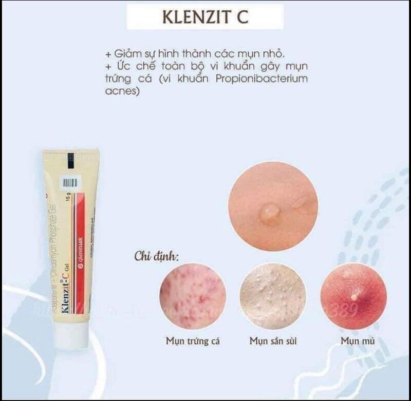 Kem trị mụn mủ, mụn bọc, mụn sưng đỏ to