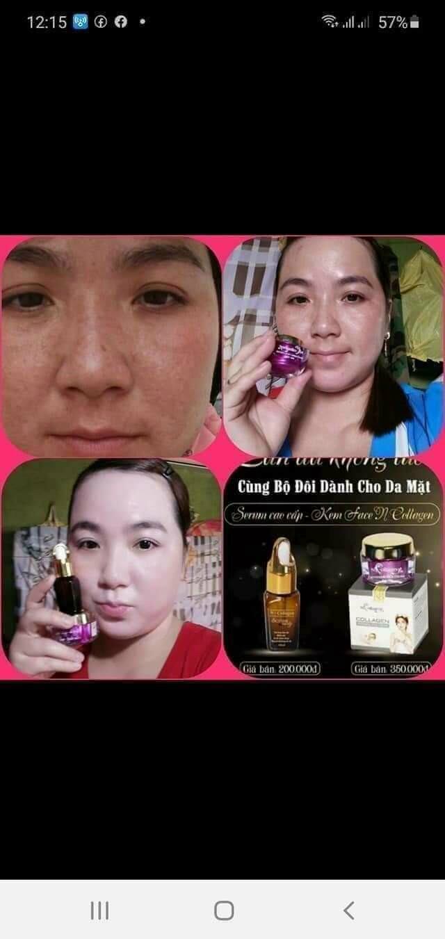 SERUM NCOLLAGEN CHÍNH HÃNG