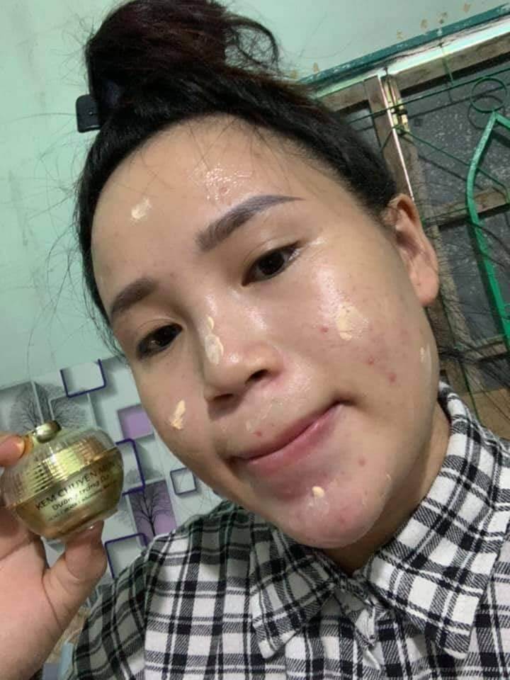 SỈ 2 HỘP FACE MỤN HUỲNH ĐỔ
