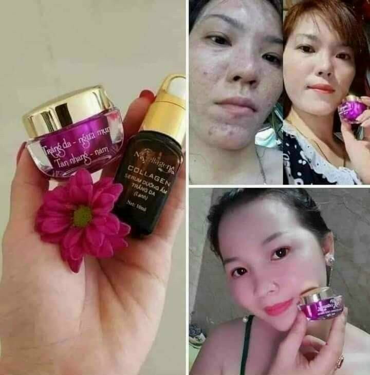 SERUM NCOLLAGEN CHÍNH HÃNG