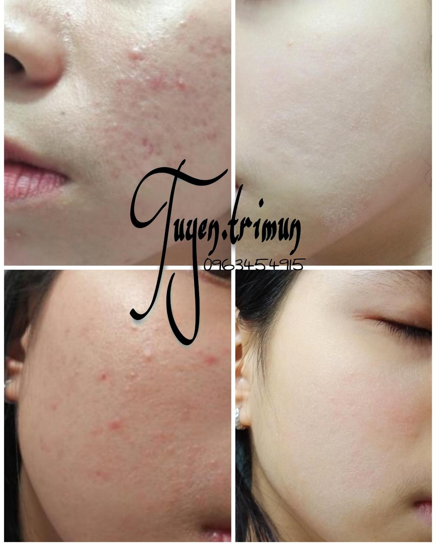 Đông y Sắc Ngọc Nữ tái tạo da