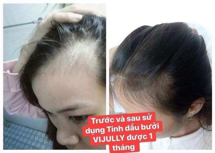 (Mẫu mới) Xịt tóc tinh dầu bưởi vijully. kích thích mọc tóc, giảm rụng tóc