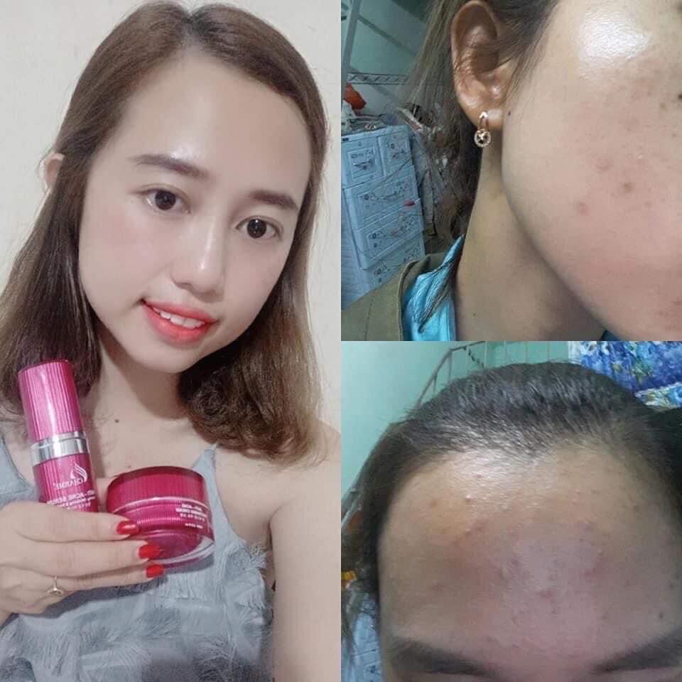 Combo Serum và Kem Thông Đỏ CHARME - Shi91 Cosmetics
