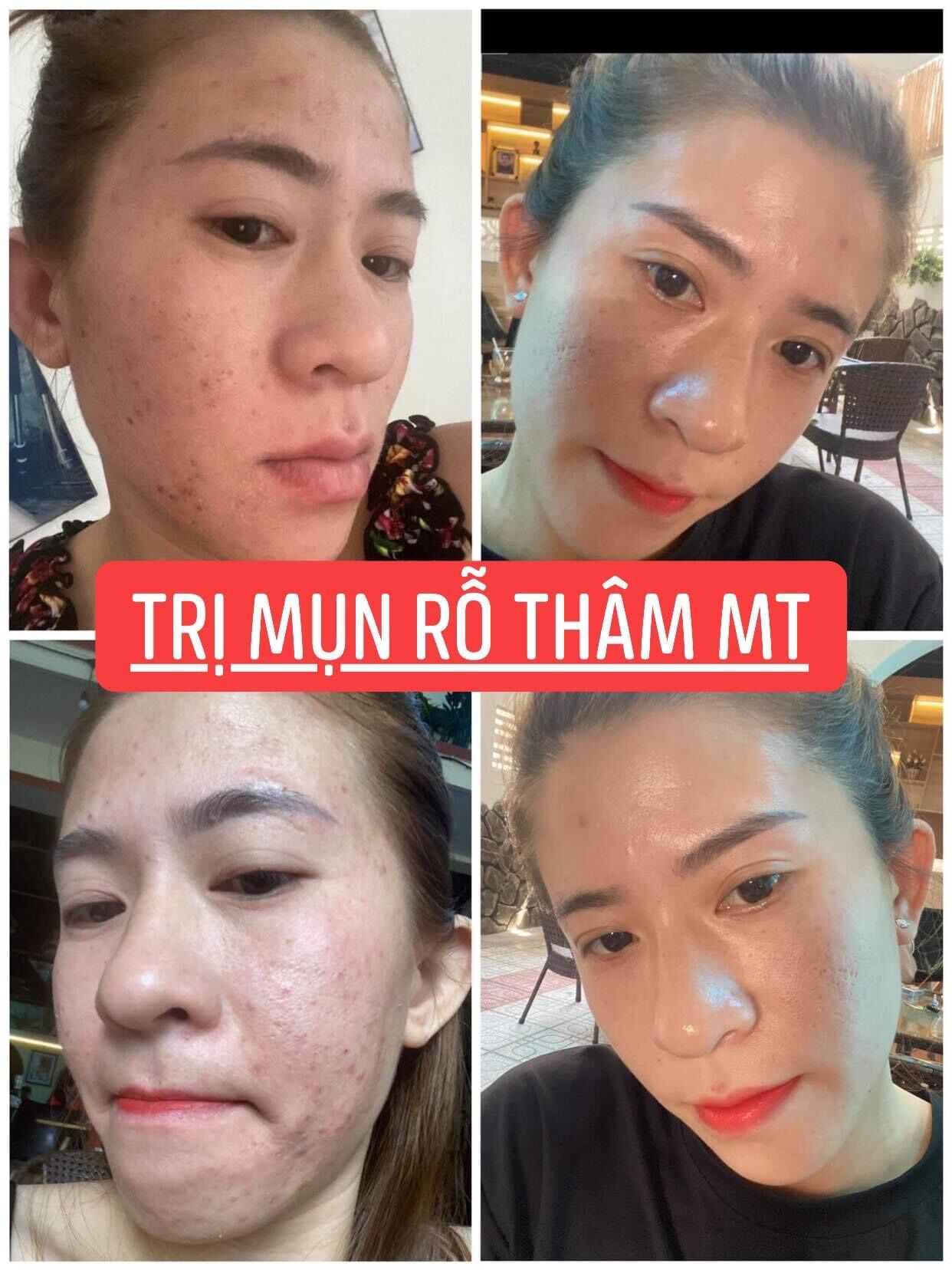 Thảo dược nhân sâm tái tạo(giá sỉ tại xưởng từ 450ml )handmade(loại chuẩn)