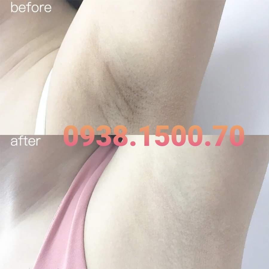 LĂN KHỬ MÙI Kwangdong Sweatclor 30ml
