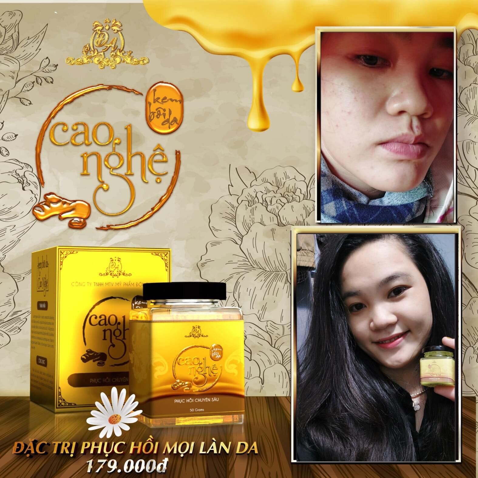 Cao nghệ Collagen X3 Đông Anh