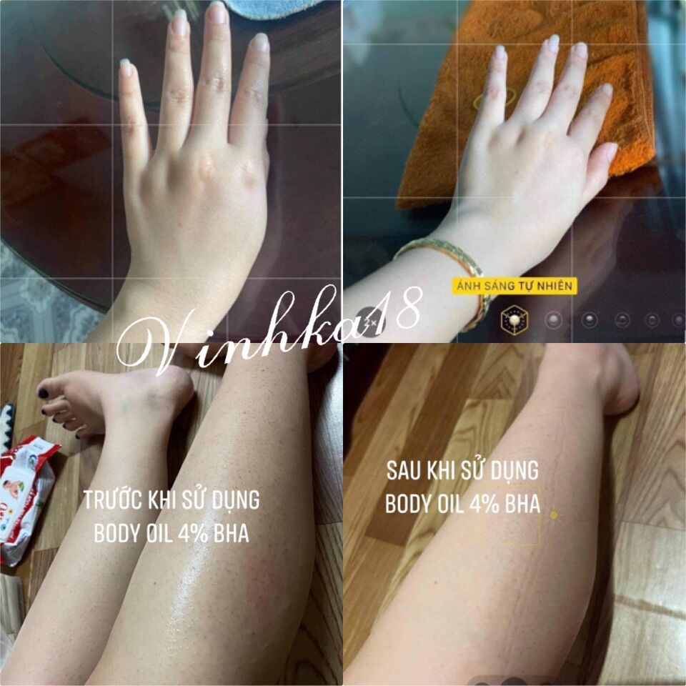 [4%BHA] Body Oil Dưỡng Trắng Da SAVANT