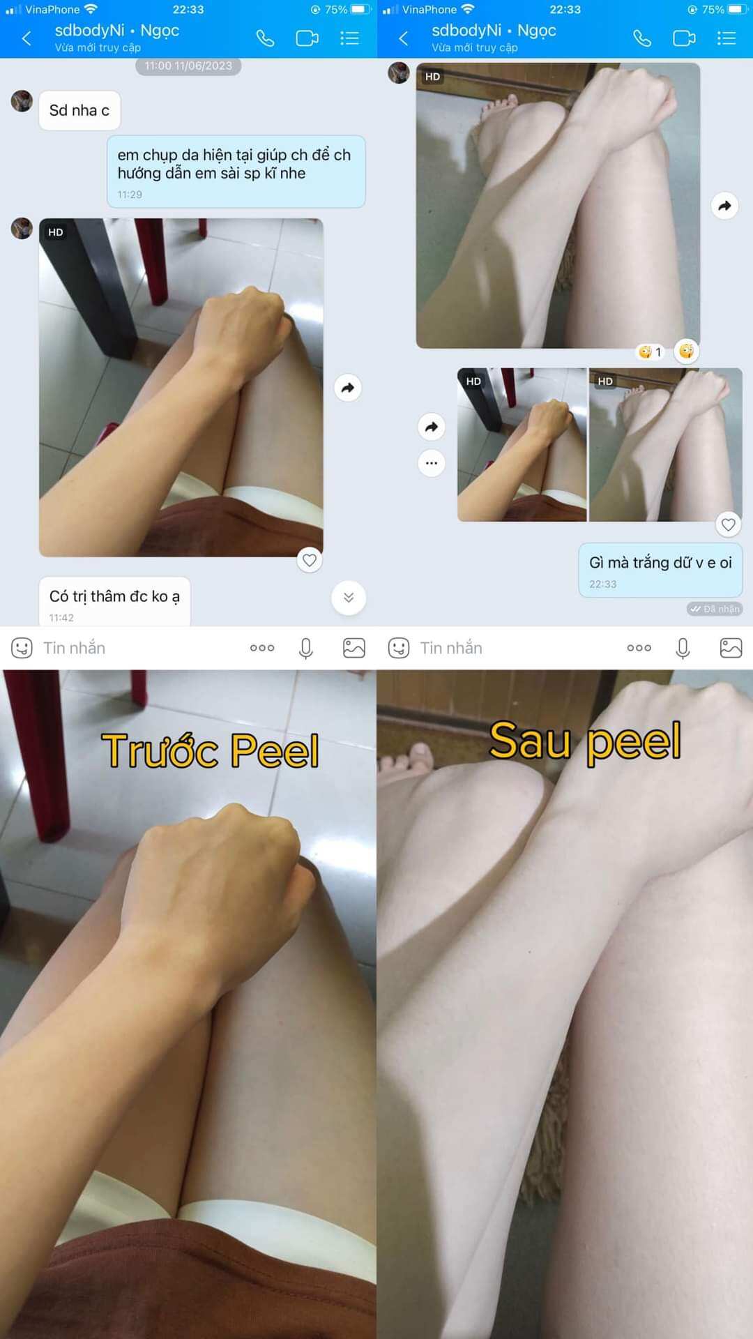 [mẫu mới]peel body,peel nách Le'peau