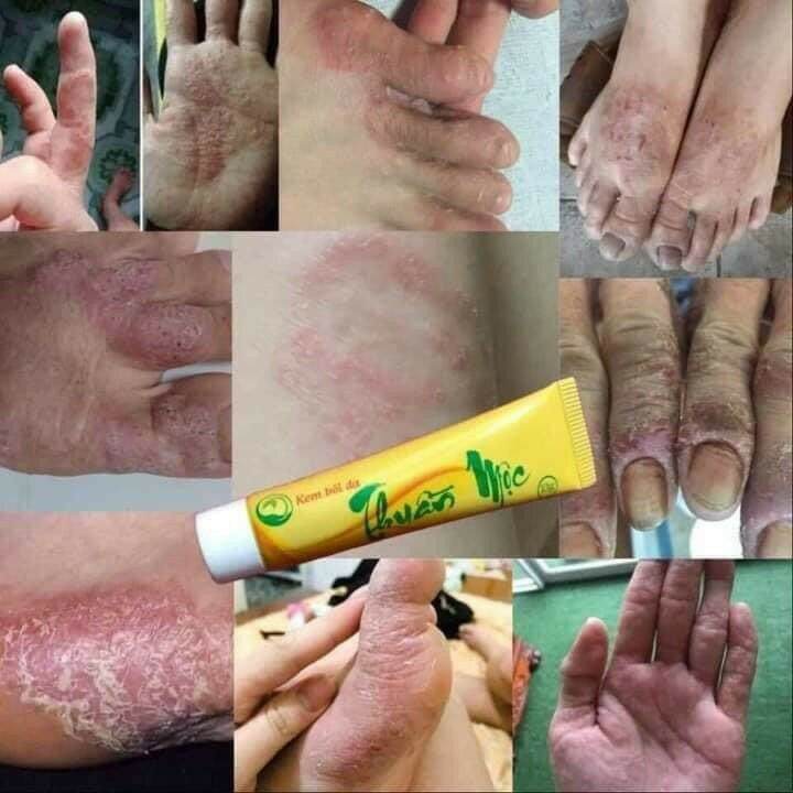 Kem bôi da thuần mộc