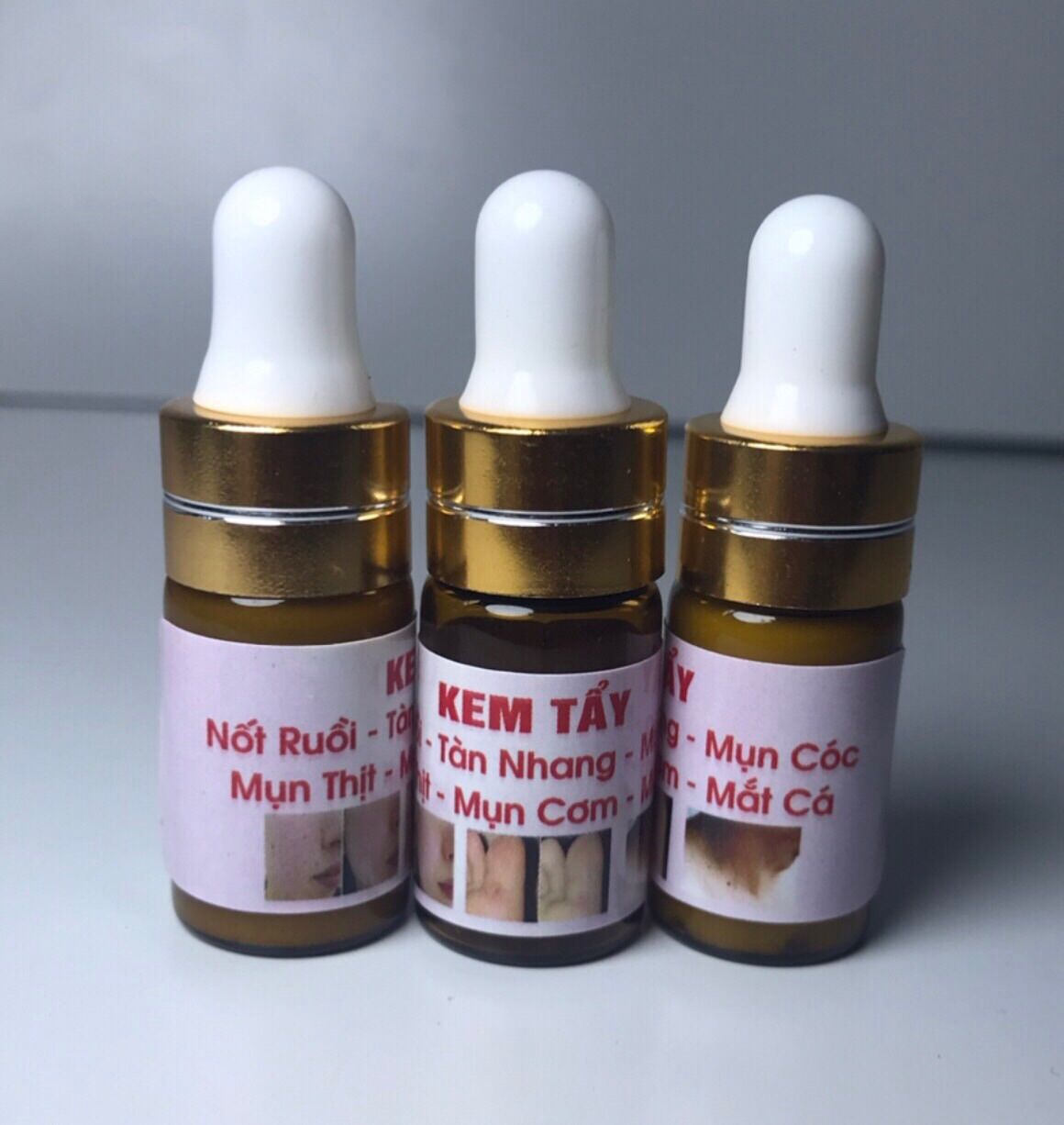 Tẩy nốt ruồi, mụn cóc, mụn cơm, mụn thịt, mắt cá hiệu quả nhanh