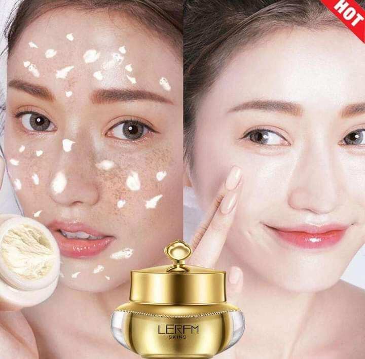 Kem dưỡng trắng da mờ nám Lerfm