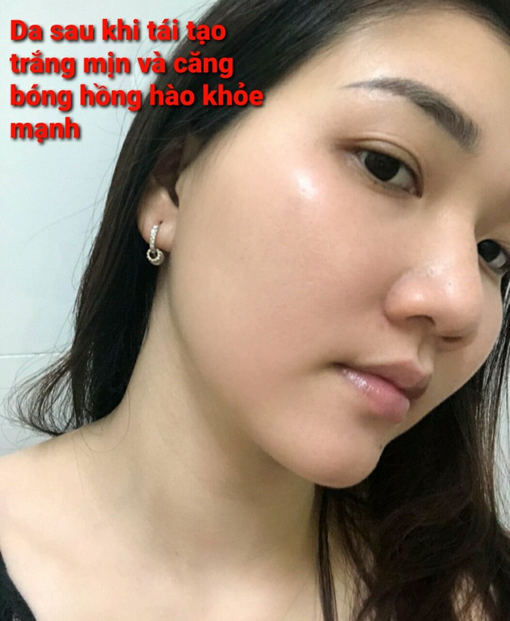HỒNG SÂM TÁI TẠO