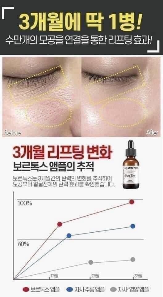 Serum botox medipeel căng bóng trắng da 30 mL