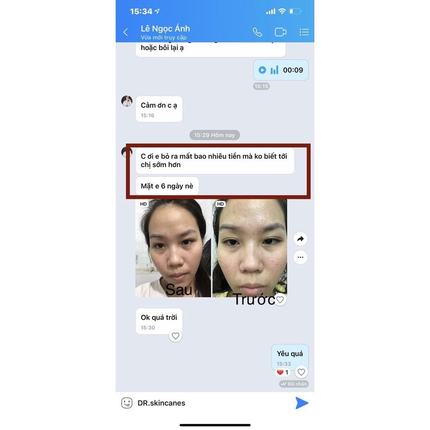 (cam kết chính hãng) SERUM XÓA MỤN THÂM DR.SKINACNES ( Dr.skin acnes )