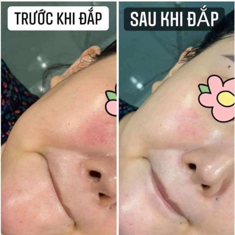 (10 miếng nạ) Mặt Nạ Cấp Ẩm, Phục Hồi Da Smas Peptide Silk Mask 24h Hydration