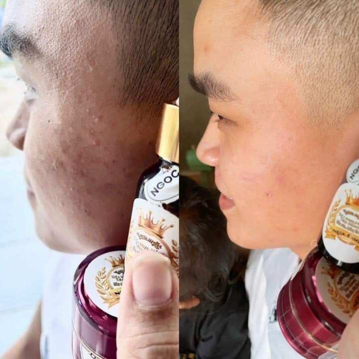 Bộ đôi Kem Face Ngọc Oanh