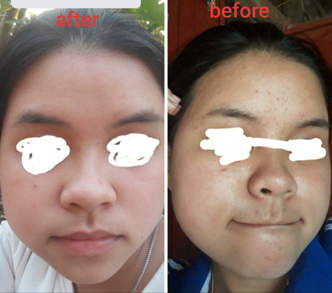 Đông y Sắc Ngọc Nữ tái tạo da
