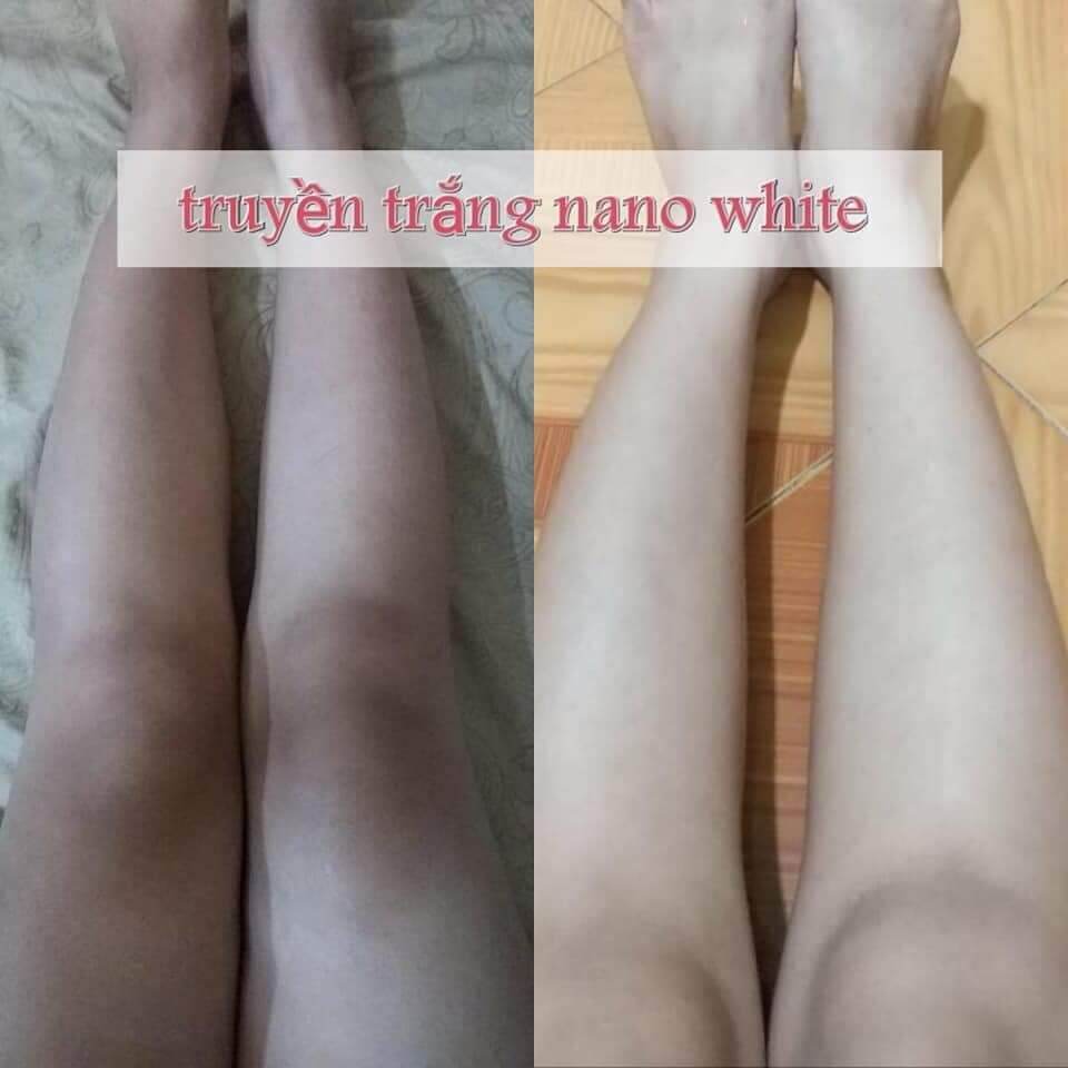 Combo 3 TẮM TRẮNG SPA - Hải Âu Việt