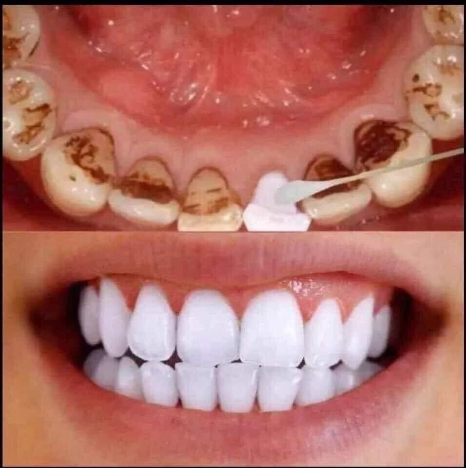 Gói dùng thử bột đánh trắng răng 100gam