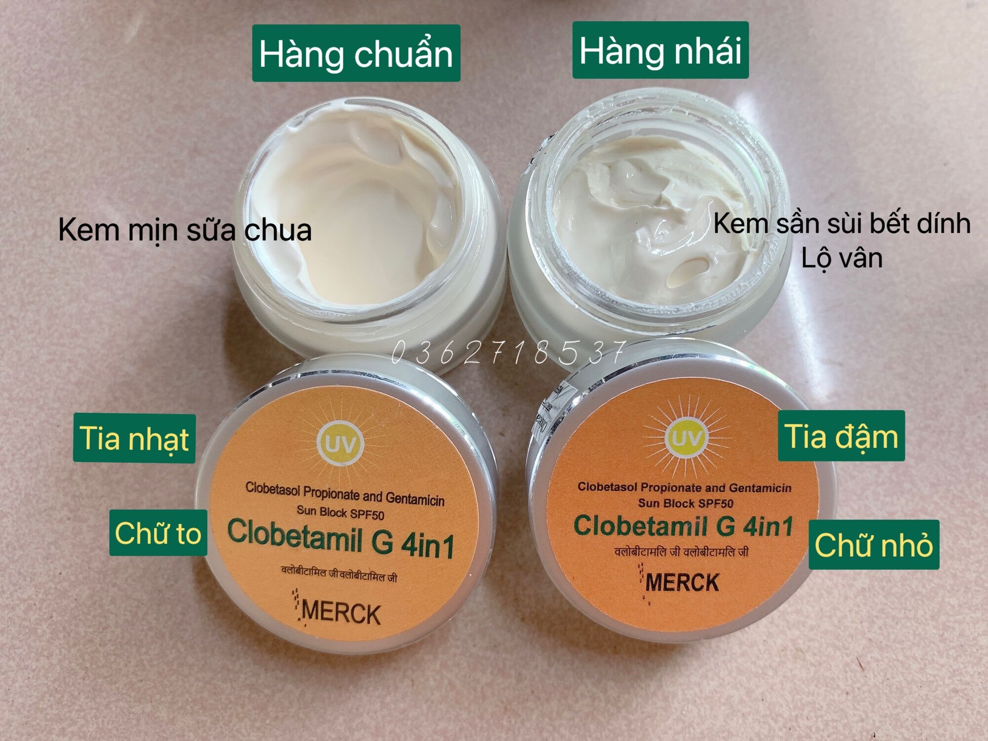 Kem nám cao cấp 4in1 thái lan