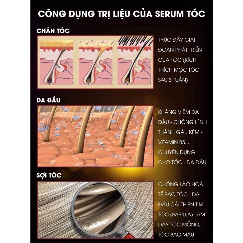 Tinh chất serum kích thích mọc tóc nhanh Weilaiya