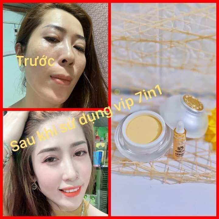 Kem face vip 7in1 Huỳnh Đỗ
