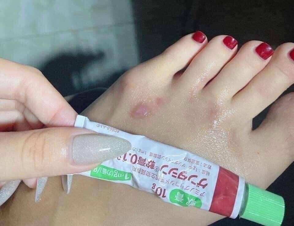 Kem Sẹo Gentacin Nhật Bản