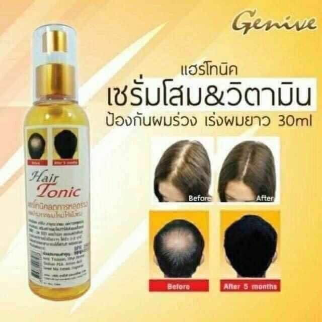 Xịt mọc tóc dài , tri hói đầu Genive Hair Tonic 120Ml