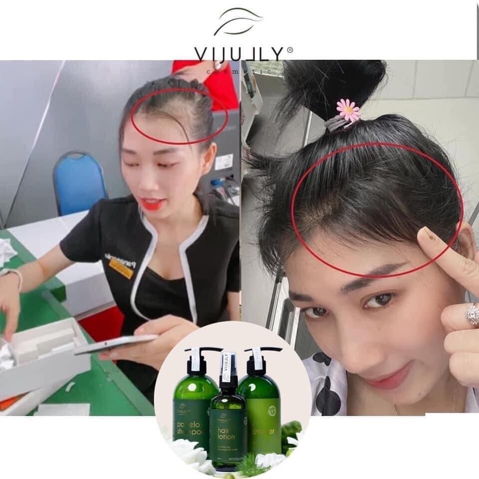 Tinh Dầu Bưởi Vi Jully