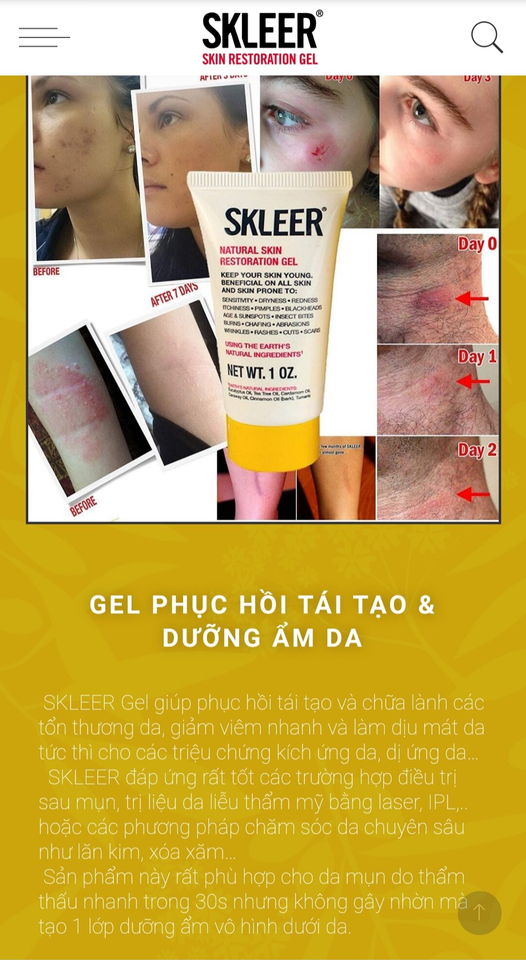 Gel hồi phục da, dưỡng ẩm Skleer