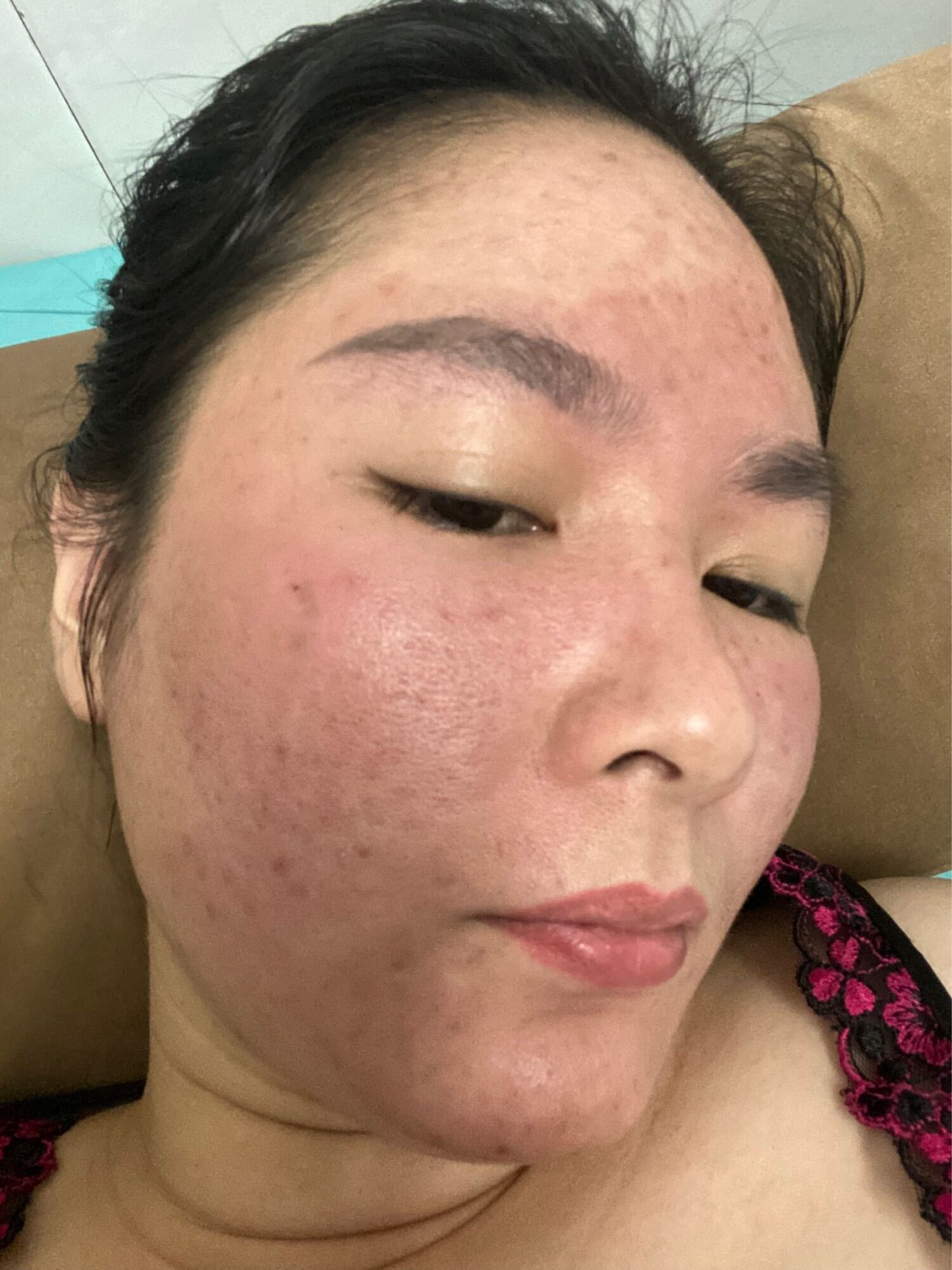 CỐT NHÂN SÂM TR.Ị M.ỤN,THÂ.M